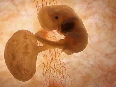 在无锡盘点多囊卵巢综合征5大禁忌，长期熬夜可能加重病情